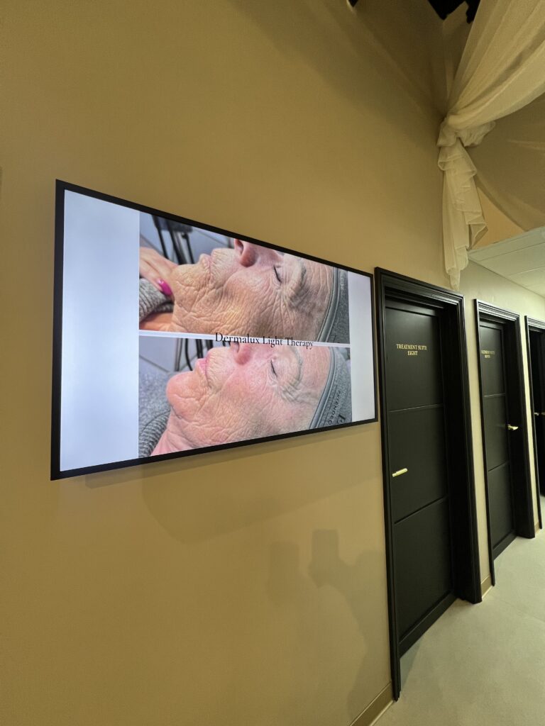 Digital display showcasing a before and after picture of an aesthetic clinic